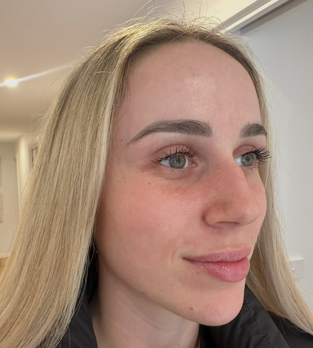 After Client