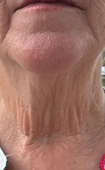 Day 1