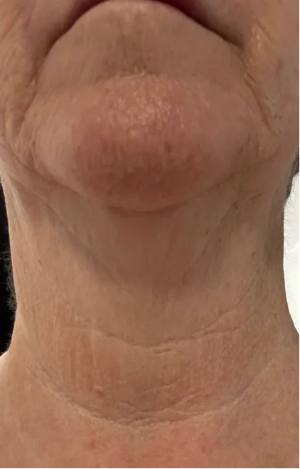 Day 17